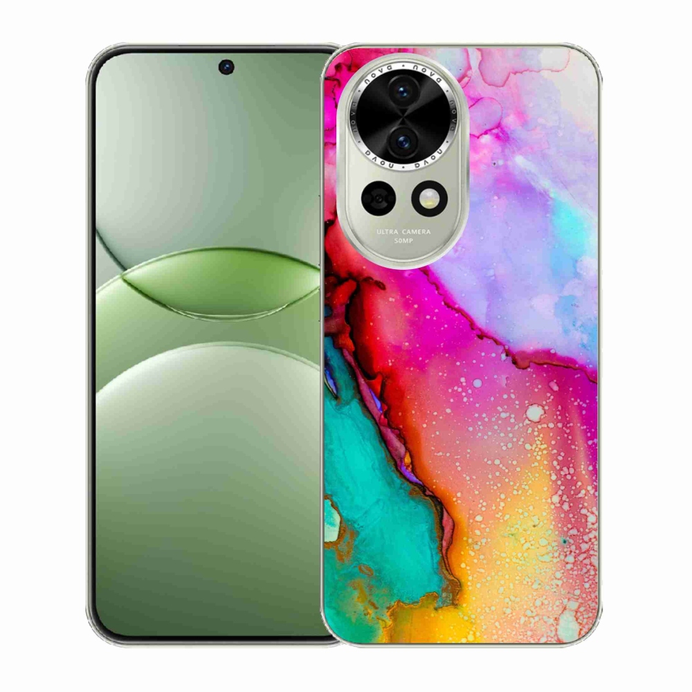 Gél borítás mmCase a Huawei Nova 13 5G-n - kivonat 24