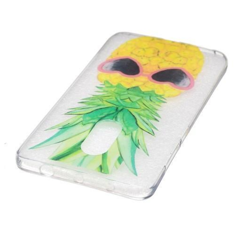 Colory zselés tok Xiaomi Redmi Note 4 - ananász