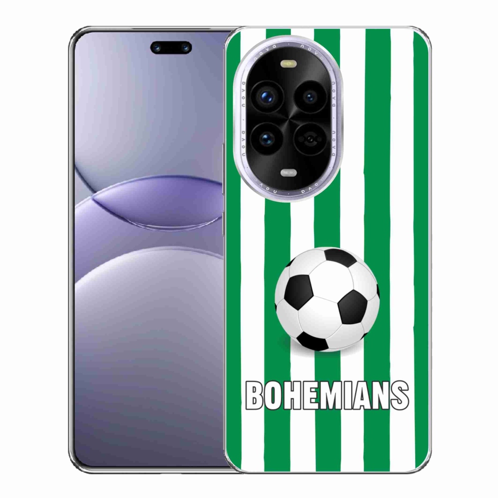 Gél borítás mmCase a Huawei Nova 13 Pro 5G-n - Bohemians