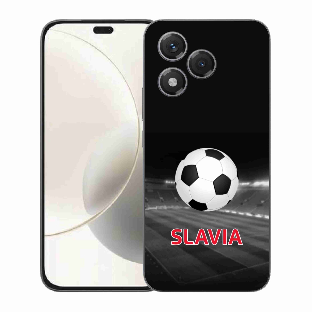 Zselés borítás mmCase a Honor 400 Lite készülékhez - slavia