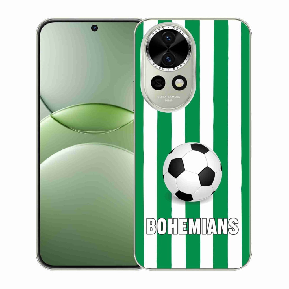 Gél borítás mmCase a Huawei Nova 13 5G-n - Bohemians