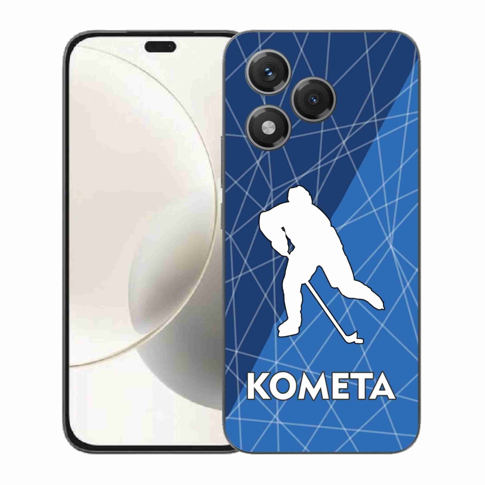 Zselés borítás mmCase a Honor 400 Lite-hoz - Comet