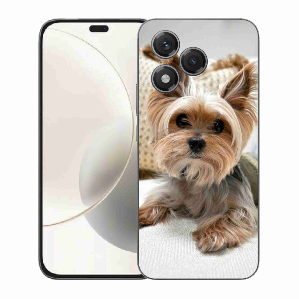 Gél borítás mmCase a Honor 400 Lite készülékhez - Yorkshire 5