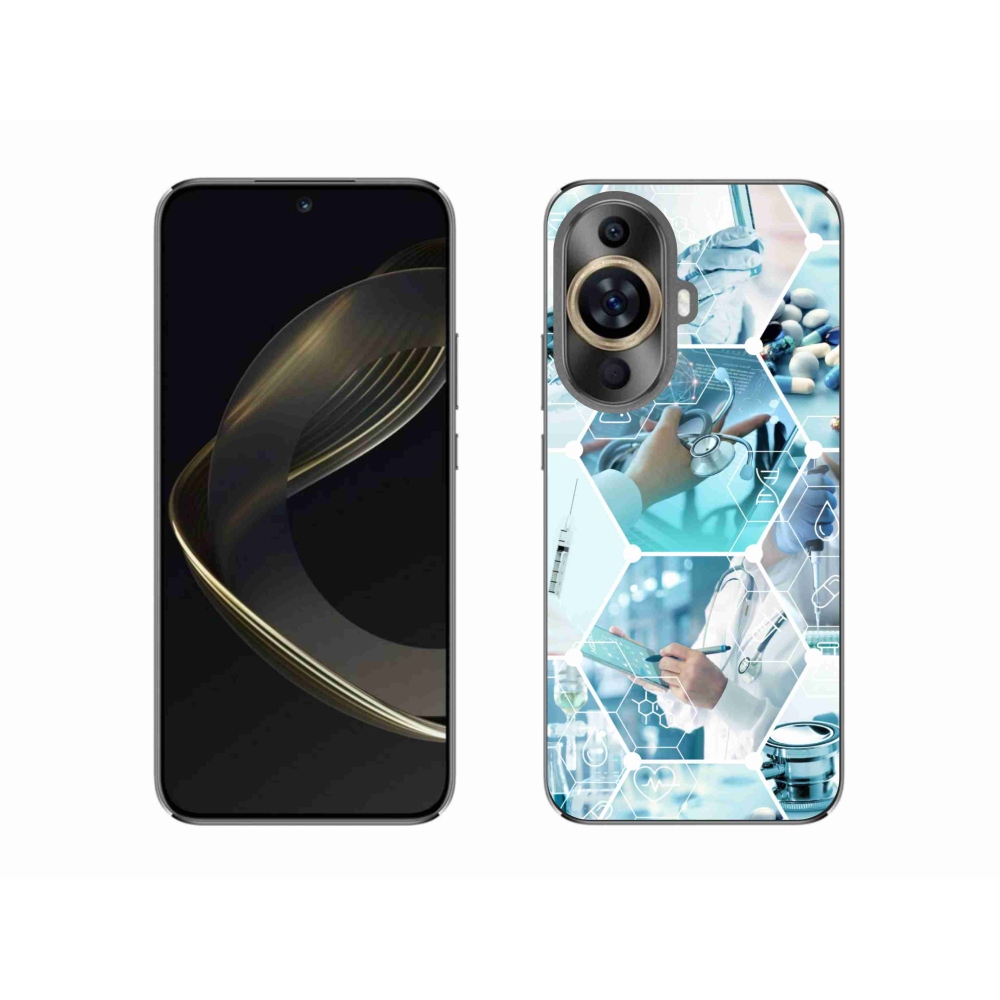 Gél borítás mmCase a Huawei Nova 11-en - egészség