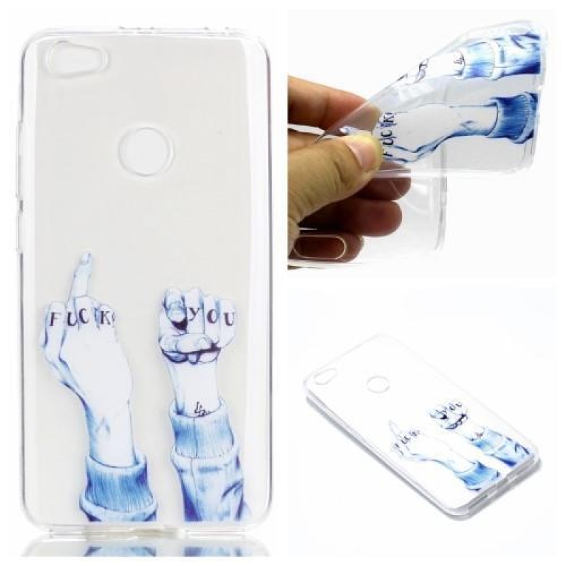 Emotive zselés tok a Xiaomi Redmi Note 5A Prime-hoz - fuck