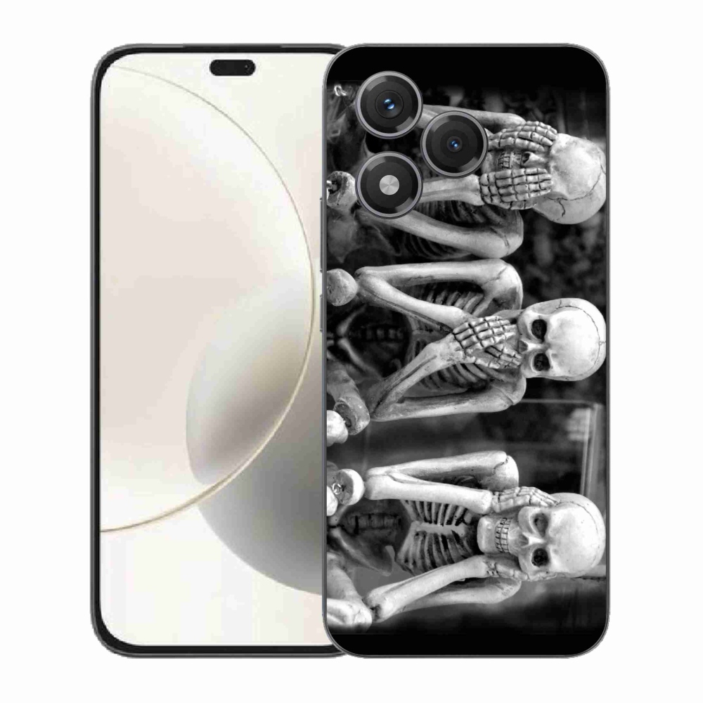 Zselés borítás mmCase a Honor 400 Lite-hoz - csontvázak