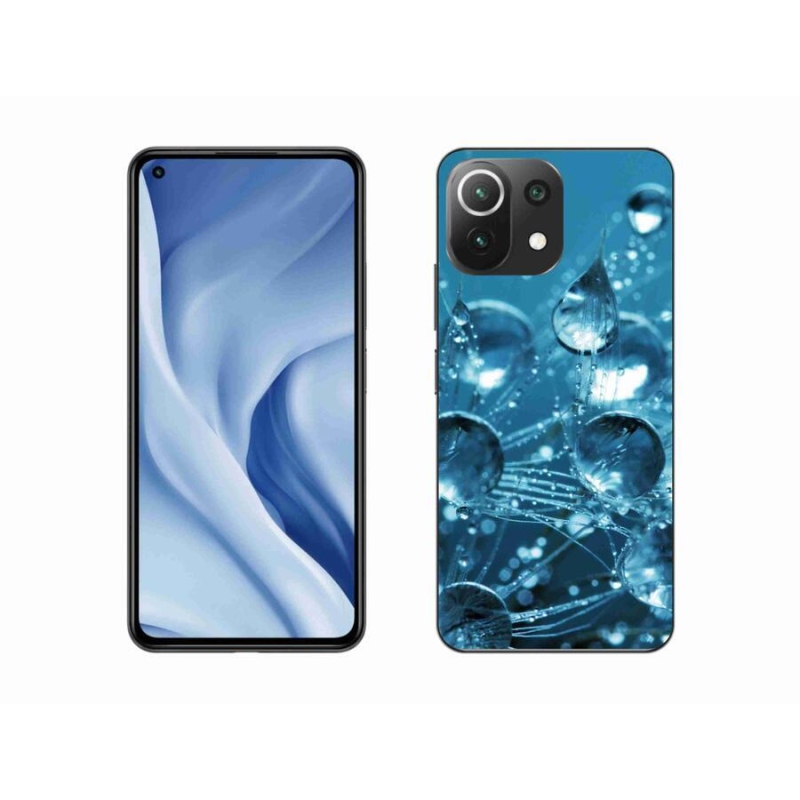Gél tok mmCase a Xiaomi 11 Lite 5G NE számára - vízcseppek