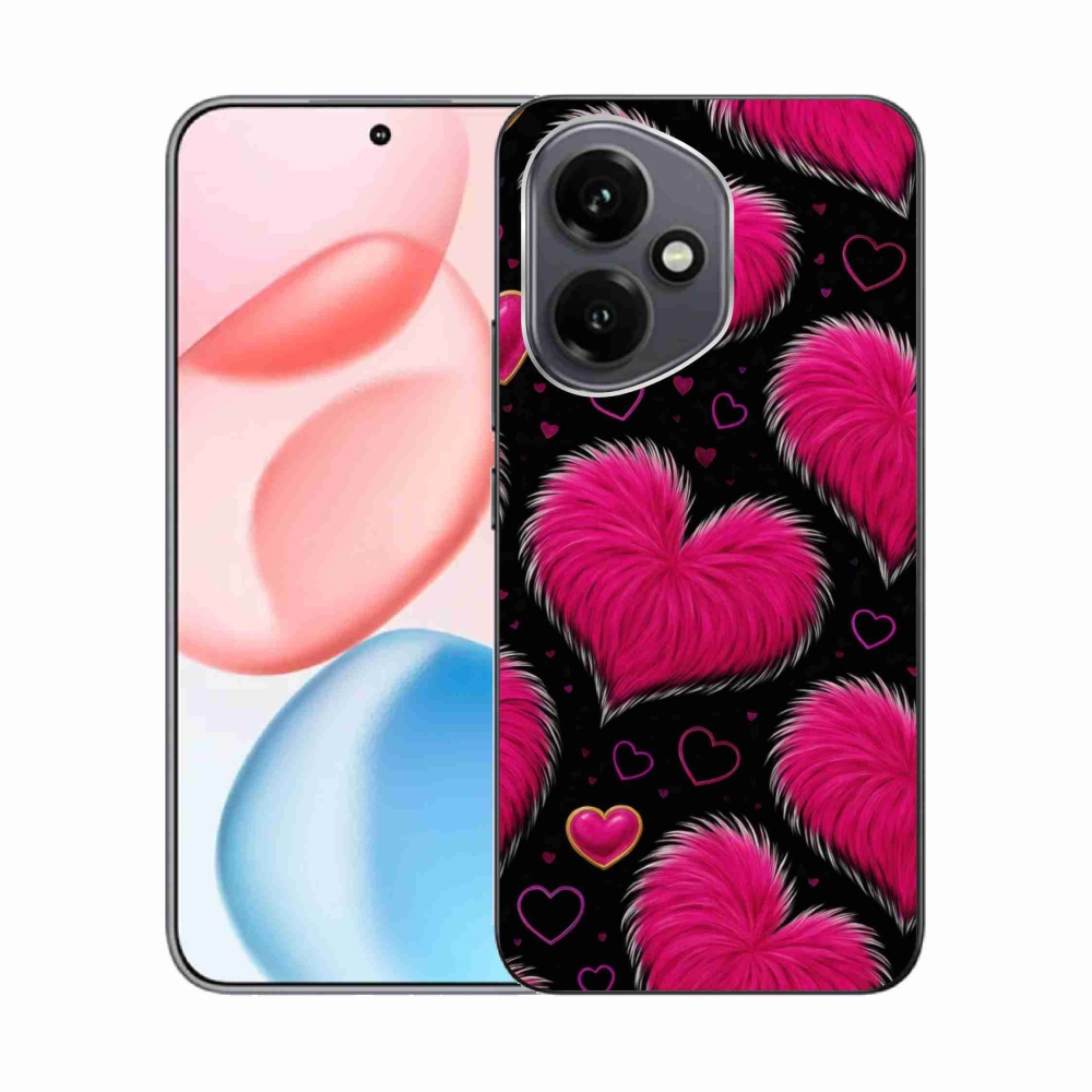 Zselés borítás mmCase a Honor 400-hoz - puha szív