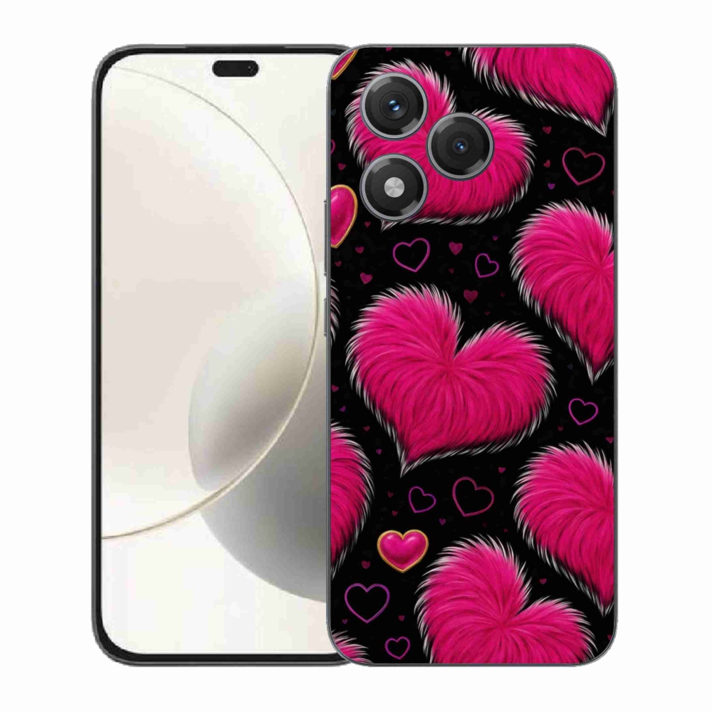 Zselés borítás mmCase a Honor 400 Lite-hoz - puha szív