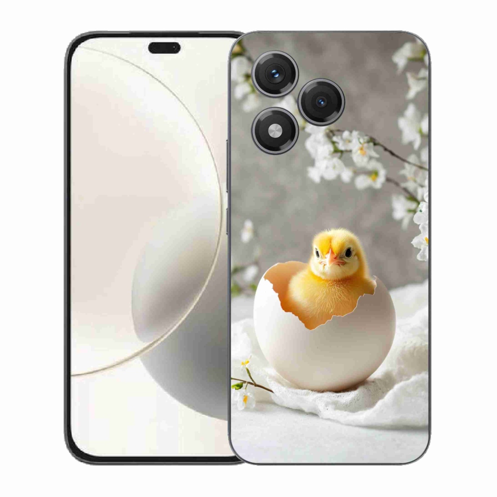 Zselés borítás mmCase a Honor 400 Lite-hoz - csaj