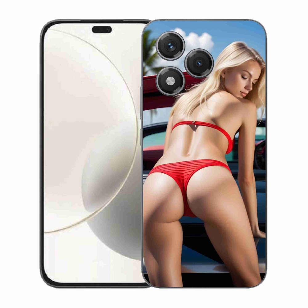 mmCase géltok az Honor 400 Lite-hoz – szexi nő 2