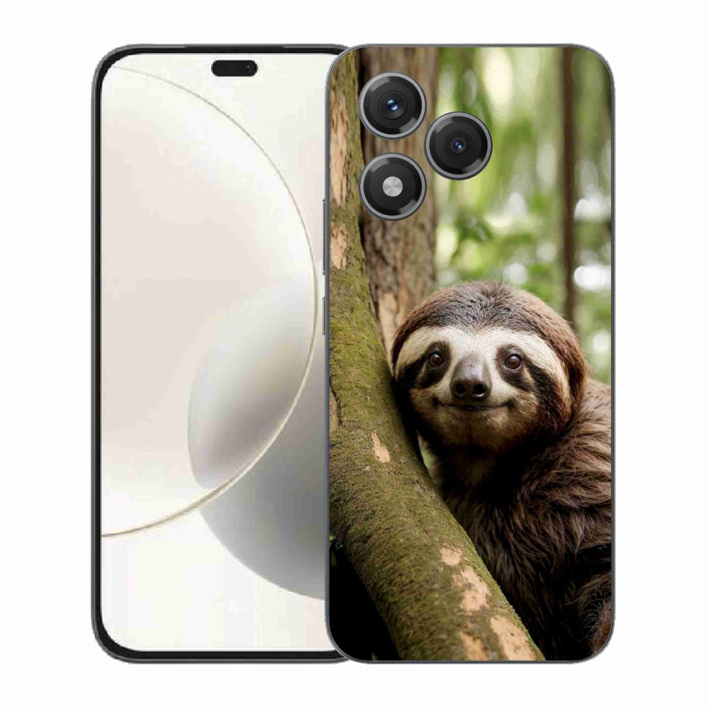mmCase géltok az Honor 400 Lite-hoz – mosolygós lajhár