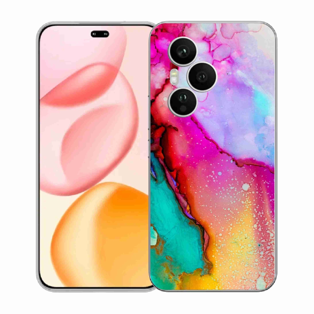 Zselés borítás mmCase a Honor 400 Pro-hoz - kivonat 24