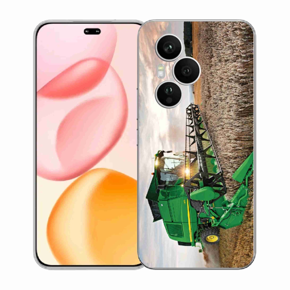 Zselés borítás mmCase a Honor 400 Pro-hoz - kombinálni