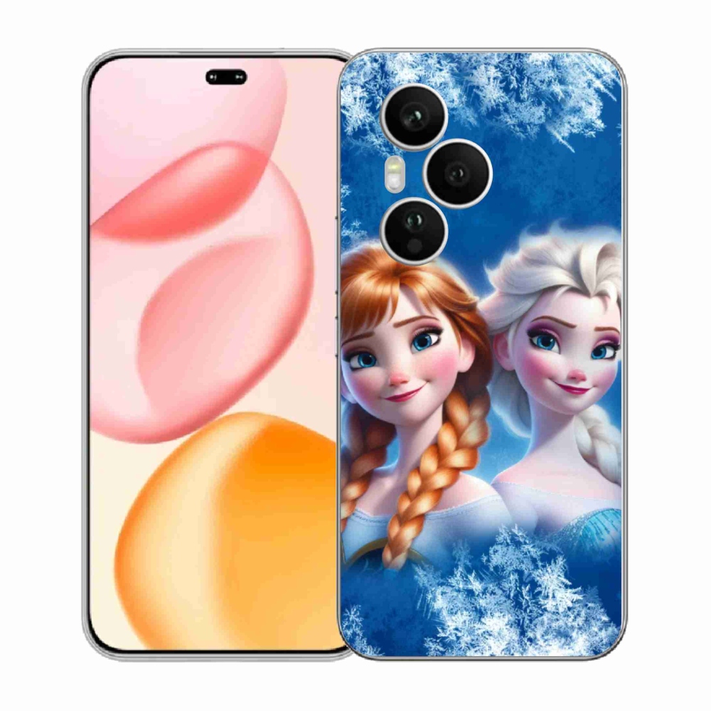 Zselés borítás mmCase a Honor 400 Pro-hoz - Ice Kingdom 2