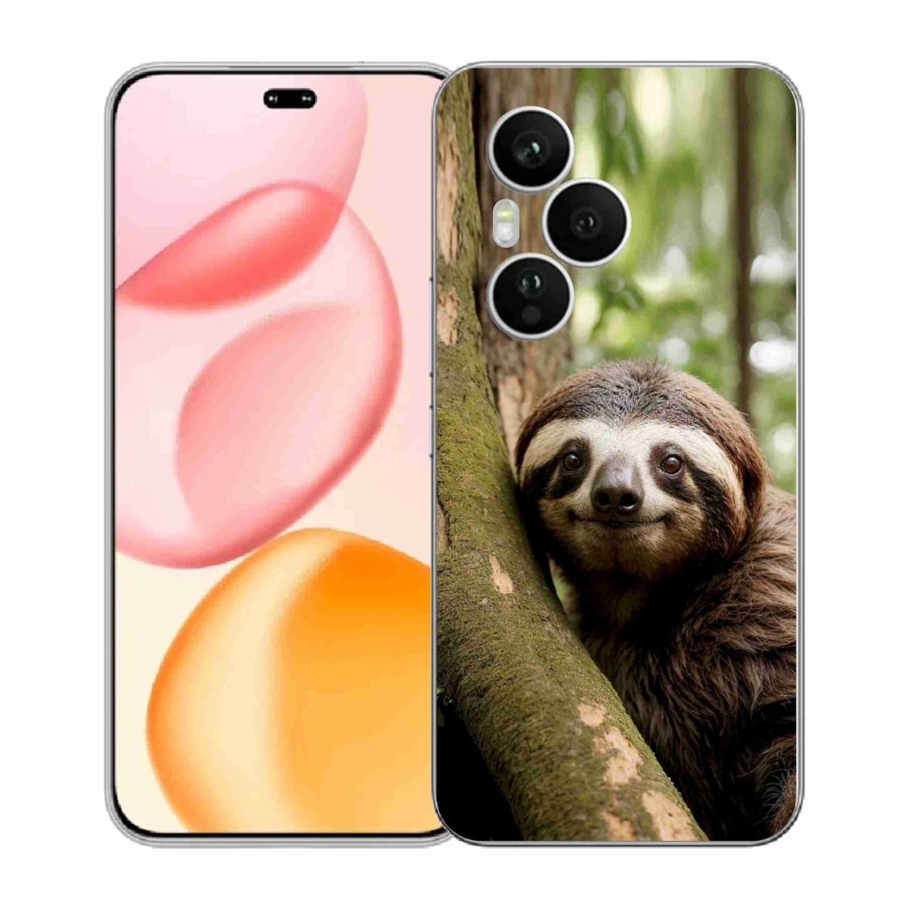 mmCase gél tok az Honor 400 Pro-hoz – mosolygós lajhár