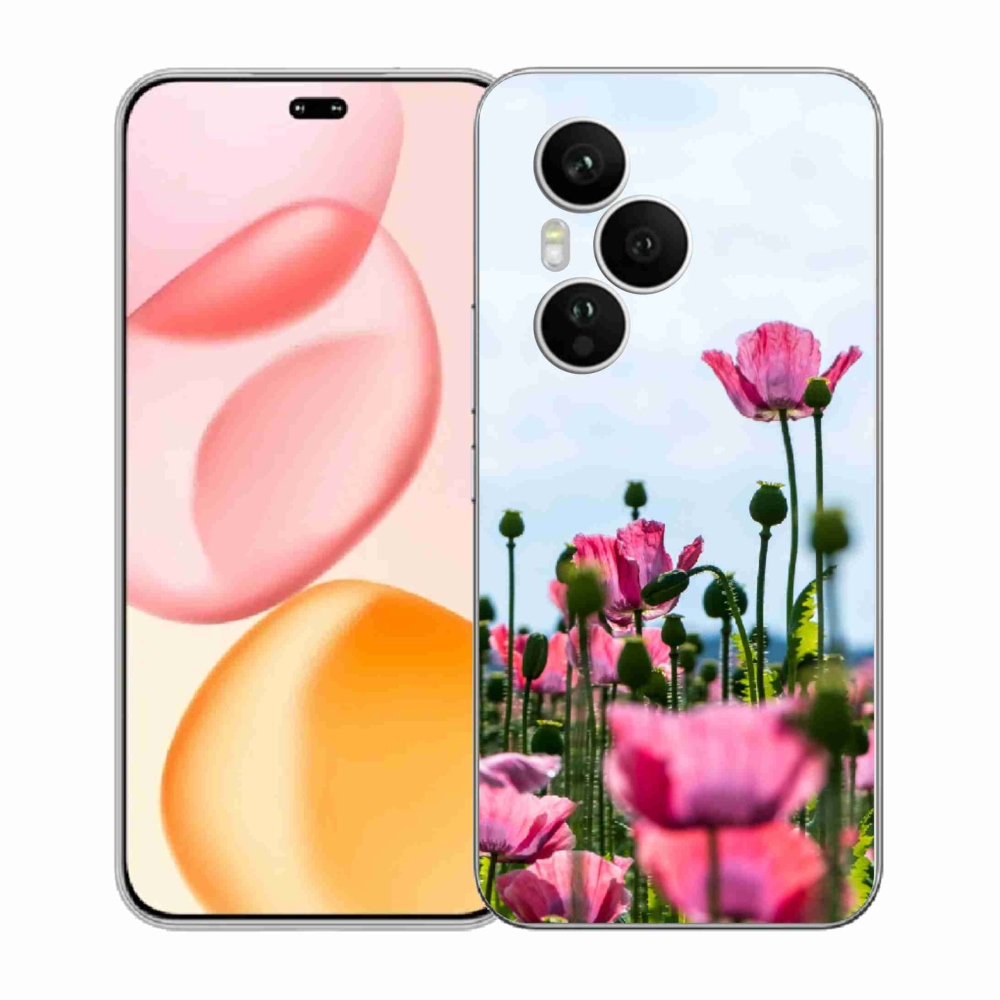 Zselés borítás mmCase a Honor 400 Pro-hoz - mákos színű