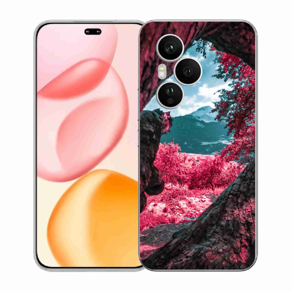 Zselés borítás mmCase a Honor 400 Pro-hoz - hegyi kilátás