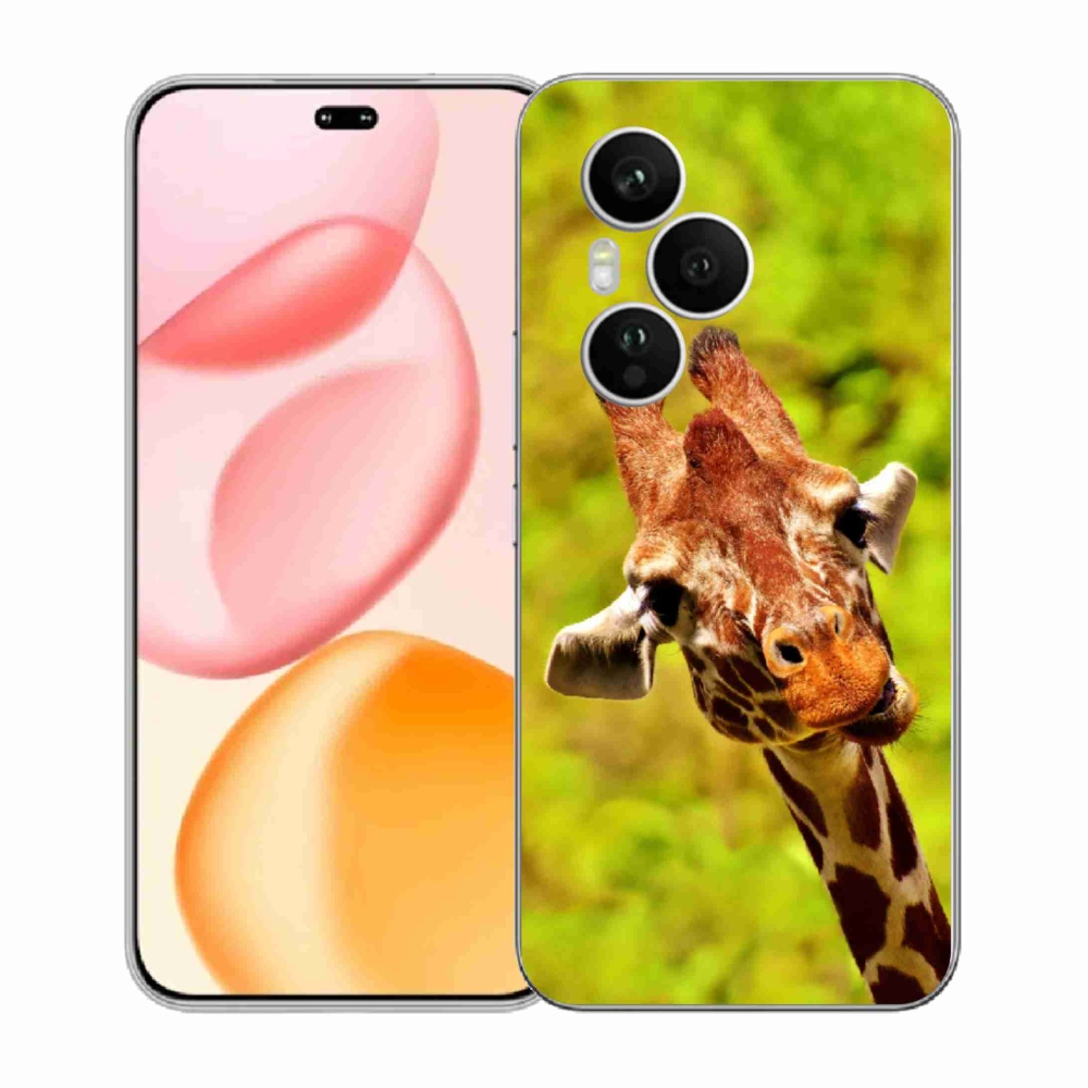 Zselés borítás mmCase a Honor 400 Pro-hoz - zsiráf