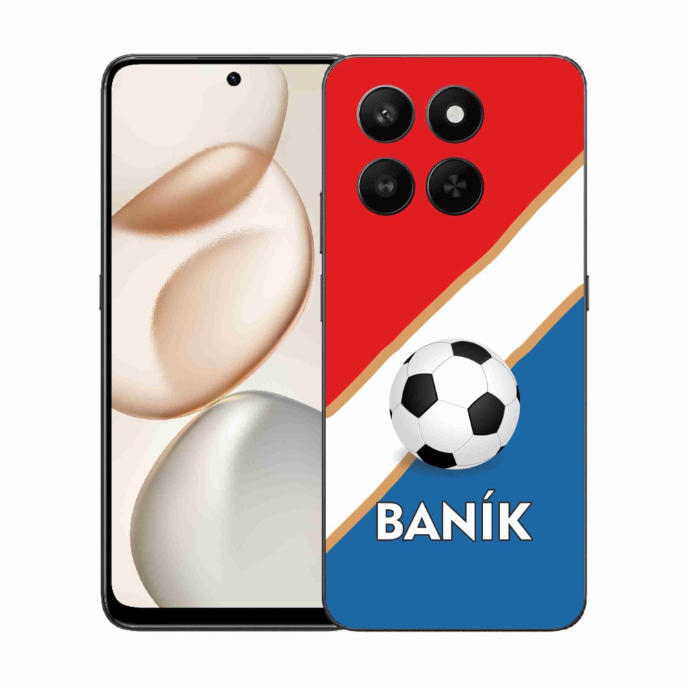 Zselés borítás mmCase a Honor 400 Smart 5G/4G/Honor X7d készülékhez - Baník