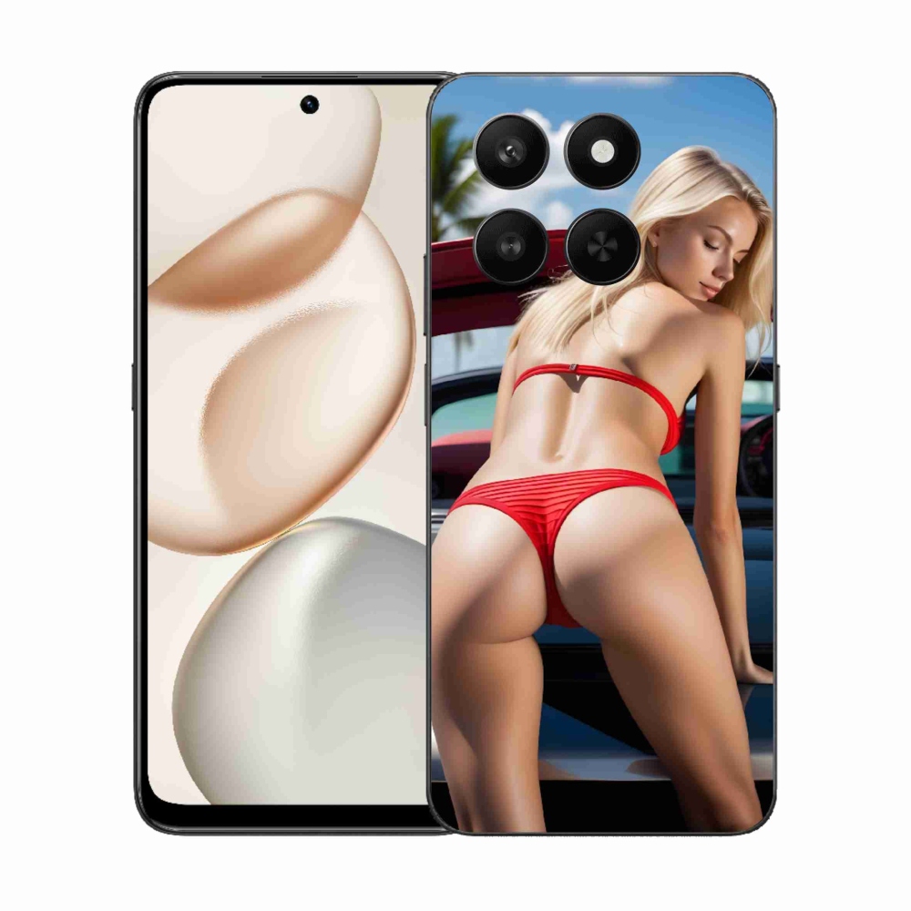 mmCase géltok az Honor 400 Smart 5G/4G/Honor X7d készülékhez – szexi nő 2
