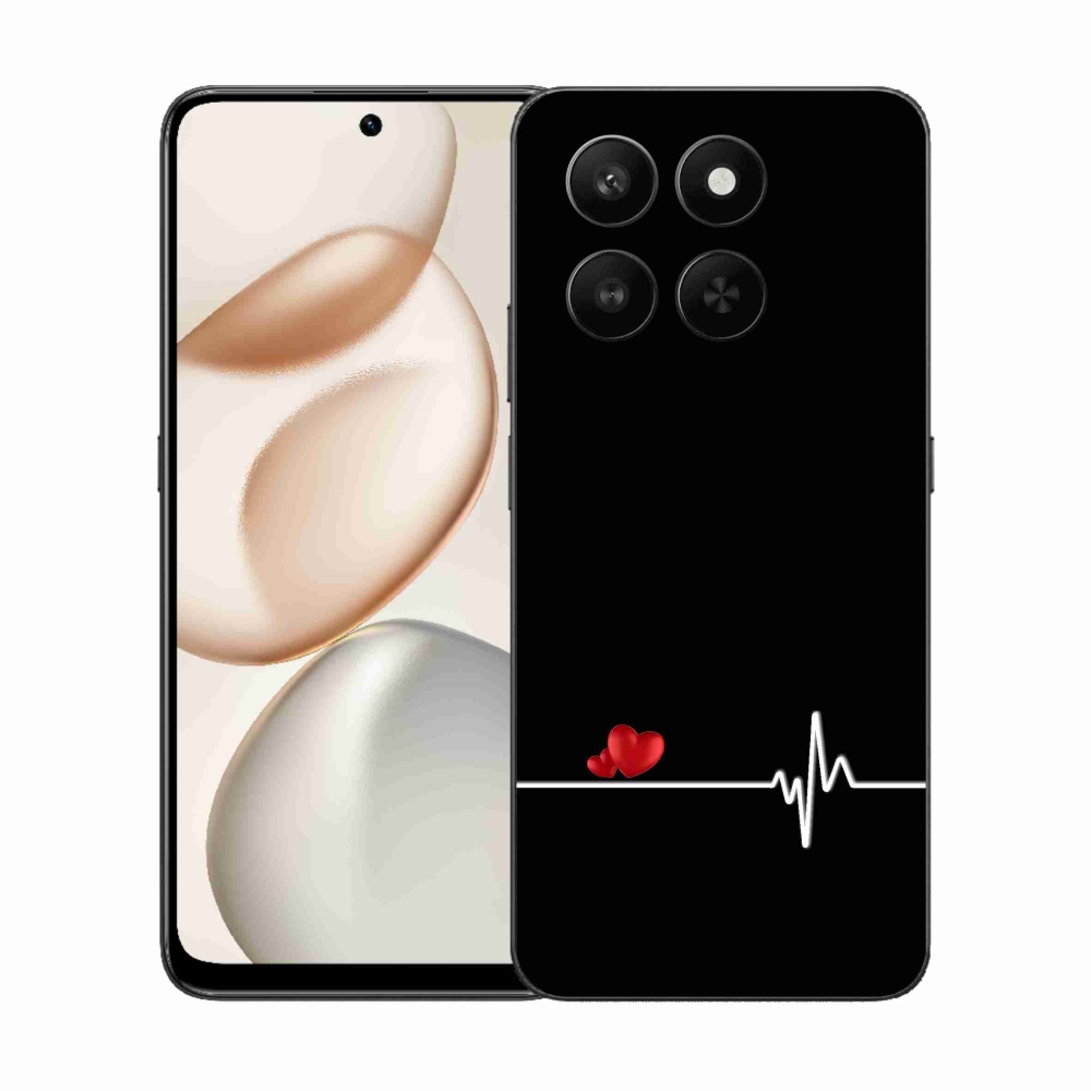 Gél borító mmCase a Honor 400 Smart 5G/4G/Honor X7d készülékhez - szív és szívverés fekete háttérrel