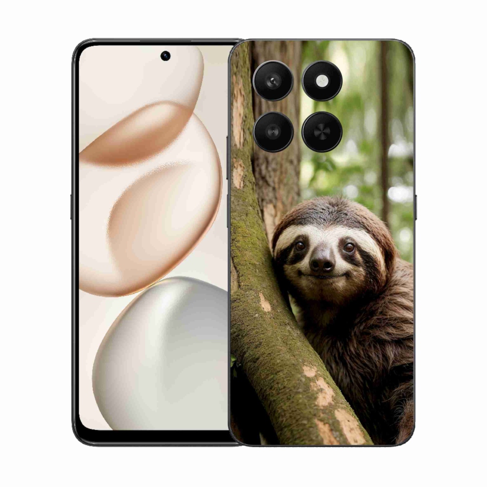 mmCase géltok az Honor 400 Smart 5G/4G/Honor X7d készülékhez – mosolygós lajhár