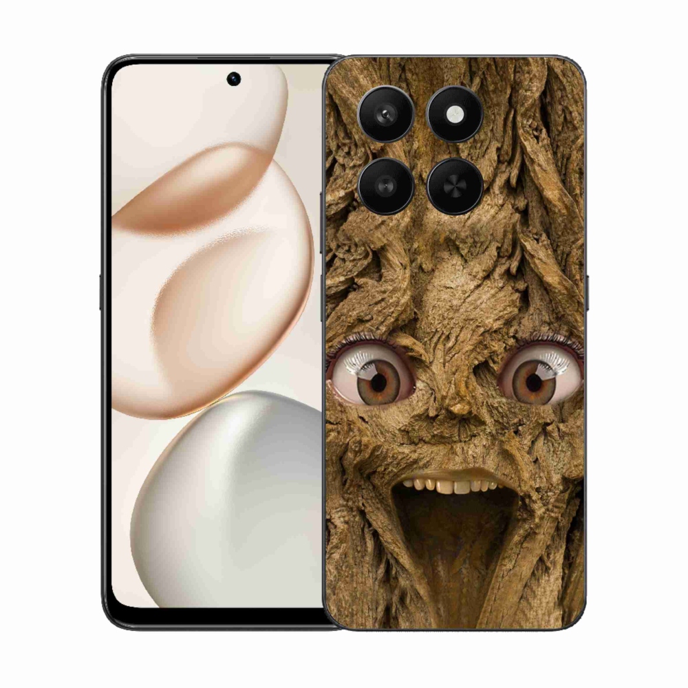 Zselés borítás mmCase a Honor 400 Smart 5G/4G/Honor X7d számára - boldog fa szemekkel