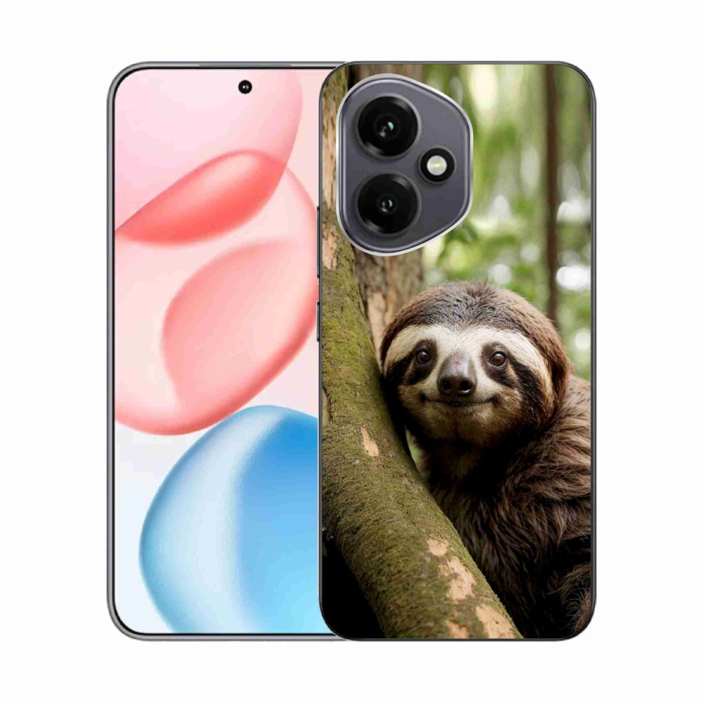 mmCase géltok az Honor 400-hoz – mosolygós lajhár