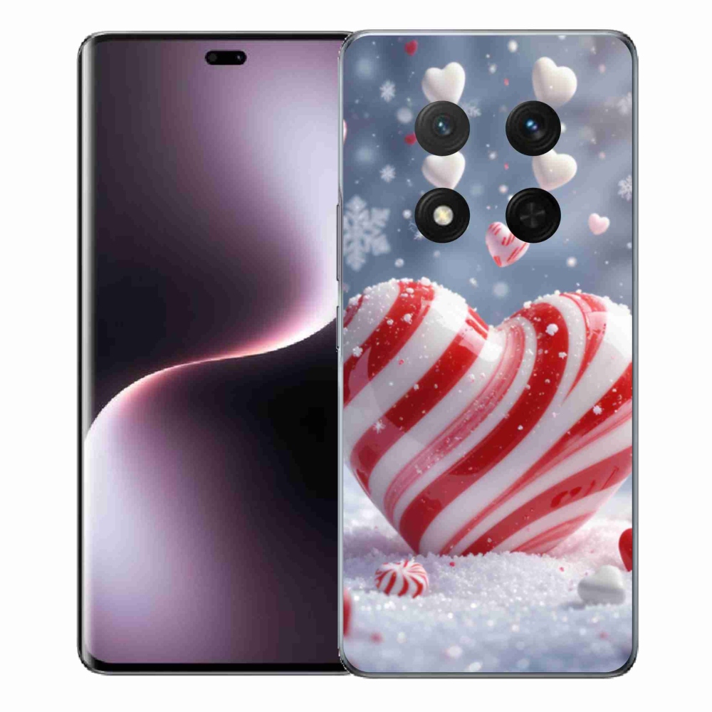 Gél borítás mmCase a Honor Magic 7 Lite 5G számára - édes szív