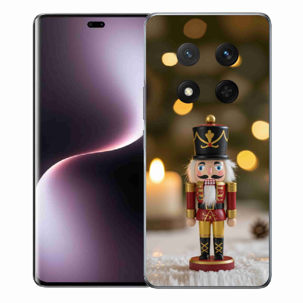 mmCase géltok az Honor Magic 7 Lite-hoz – diótörő