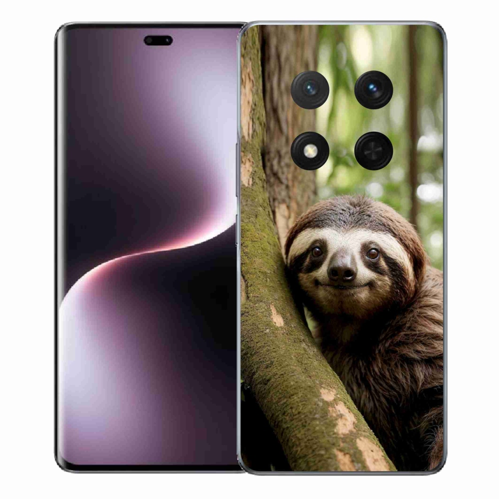 mmCase géltok az Honor Magic 7 Lite-hoz – mosolygós lajhár