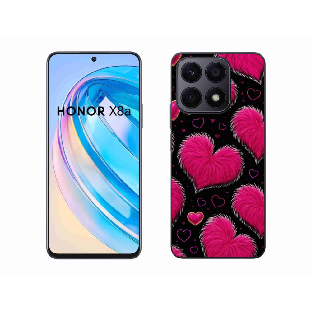 Gél borítás mmCase a Honor X8a készülékhez - puha szív