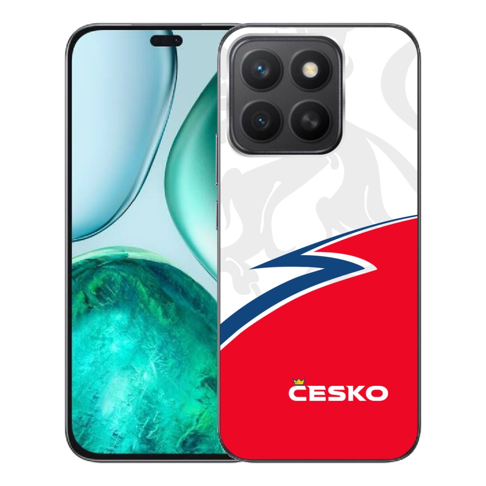 mmCase géltok az Honor X8c-hez – Csehország 1