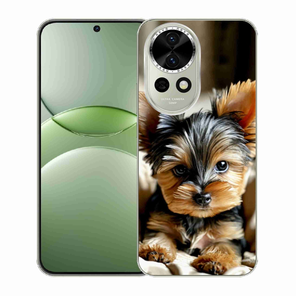 Gél borítás mmCase a Huawei Nova 13 5G készülékhez - Yorkshire 11