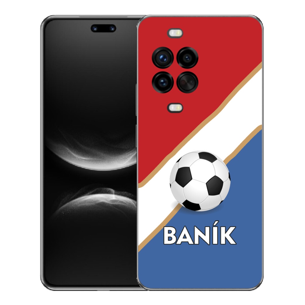mmCase géltok a Huawei Nova 14 Pro-hoz – Baník