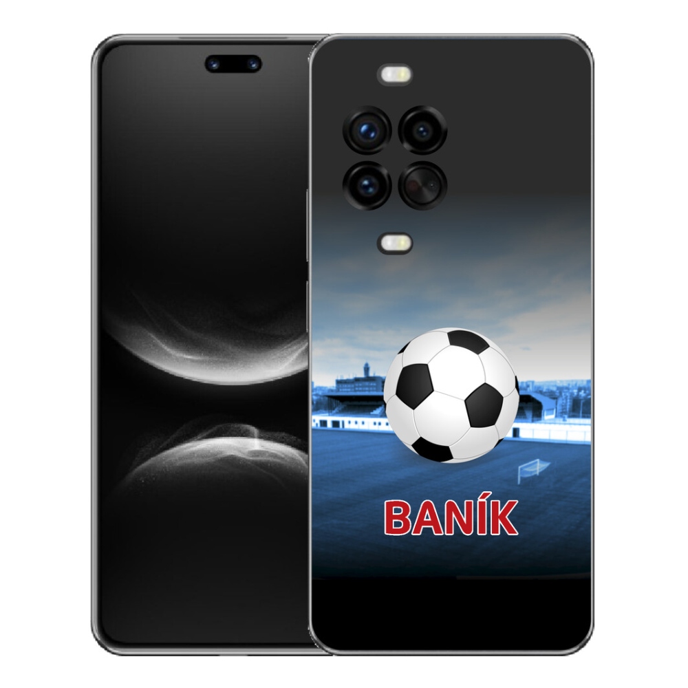 mmCase géltok a Huawei Nova 14 Pro-hoz – baník 2