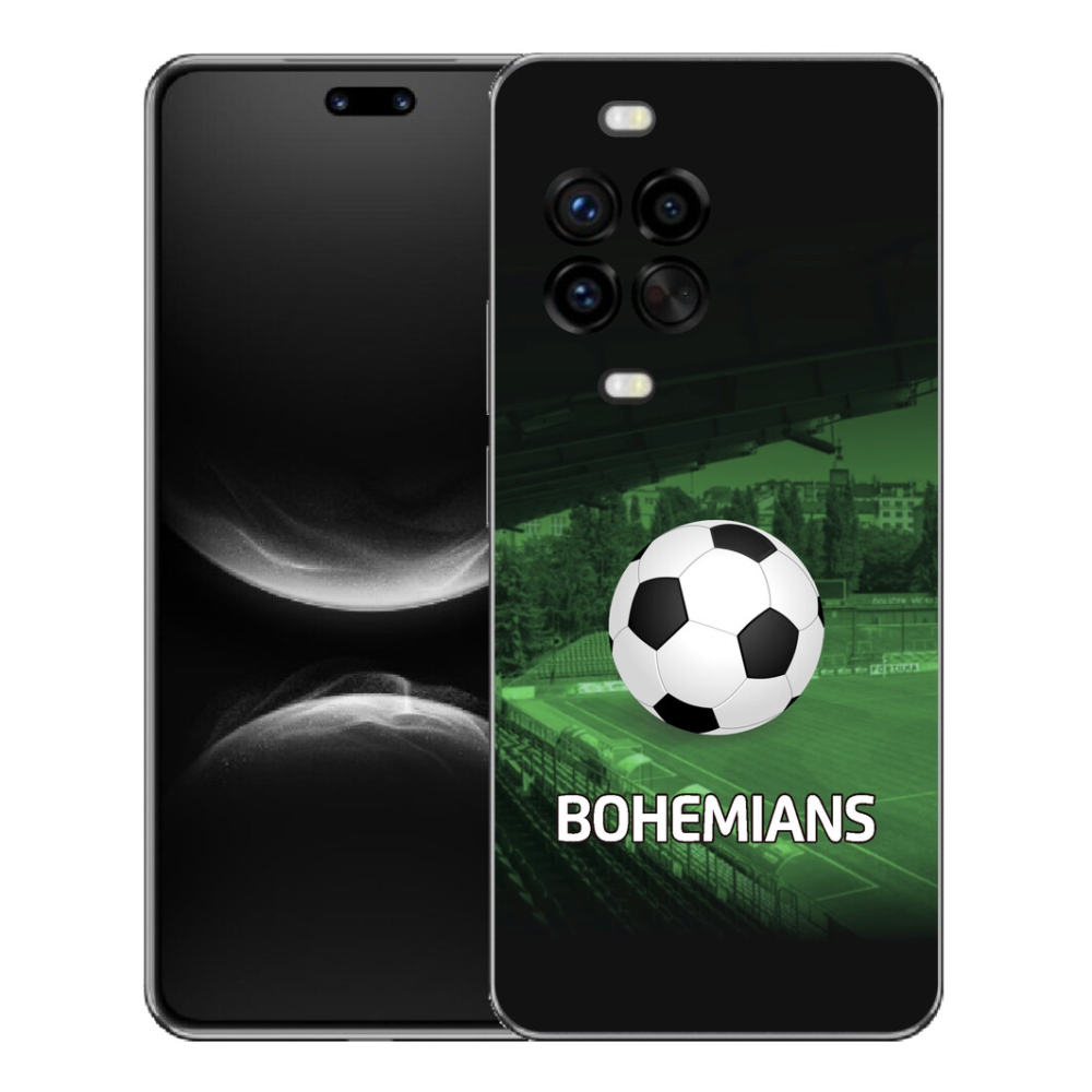 mmCase géltok a Huawei Nova 14 Pro-hoz – bohemians 1