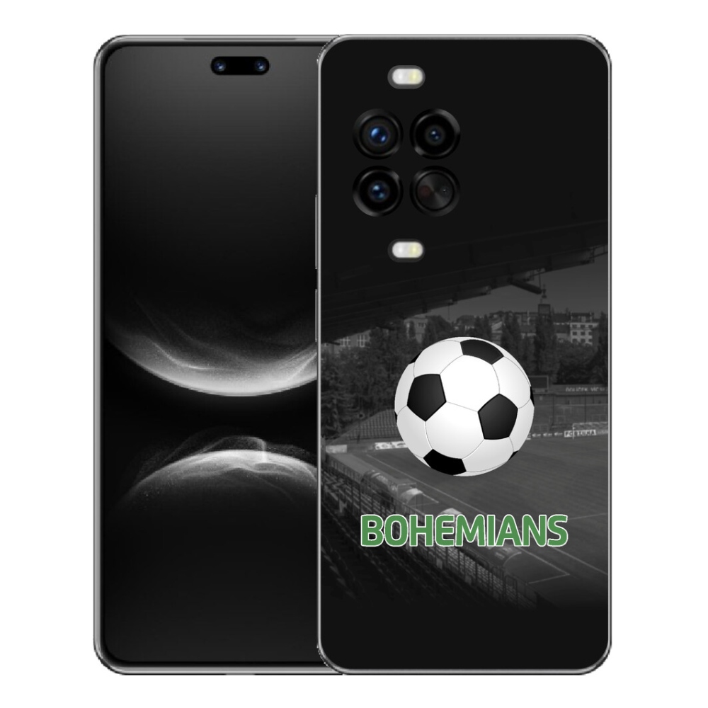 mmCase géltok a Huawei Nova 14 Pro-hoz – bohemians 2