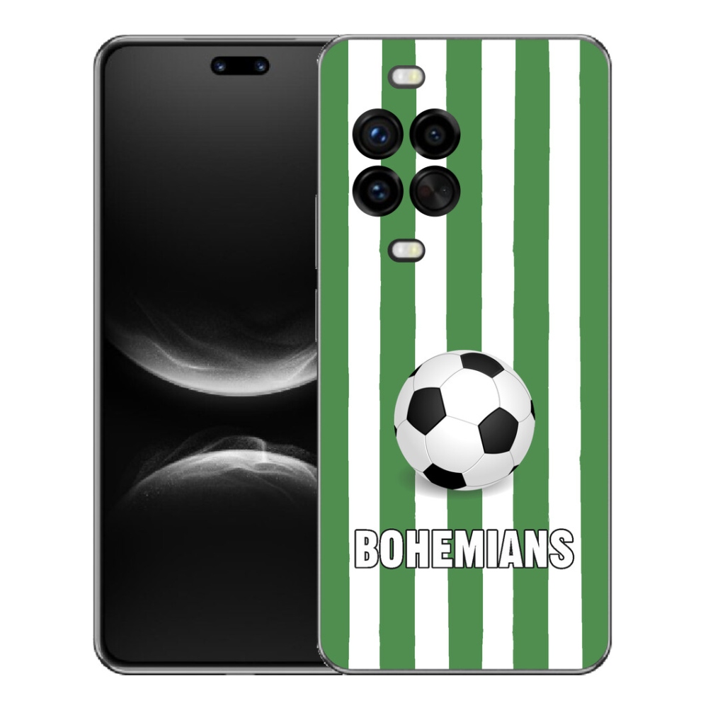 mmCase géltok a Huawei Nova 14 Pro-hoz – Bohemians