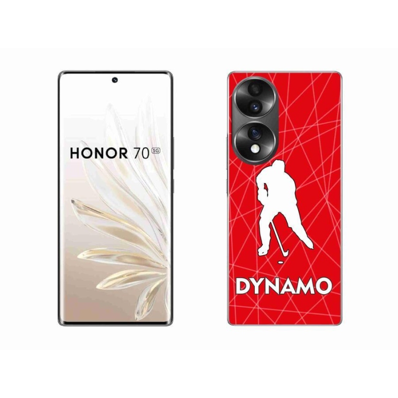 Zselés borítás mmCase a Honor 70 - Dynamo 2 készülékhez