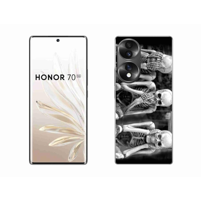 Zselés borítás mmCase Honor 70 - csontvázakhoz