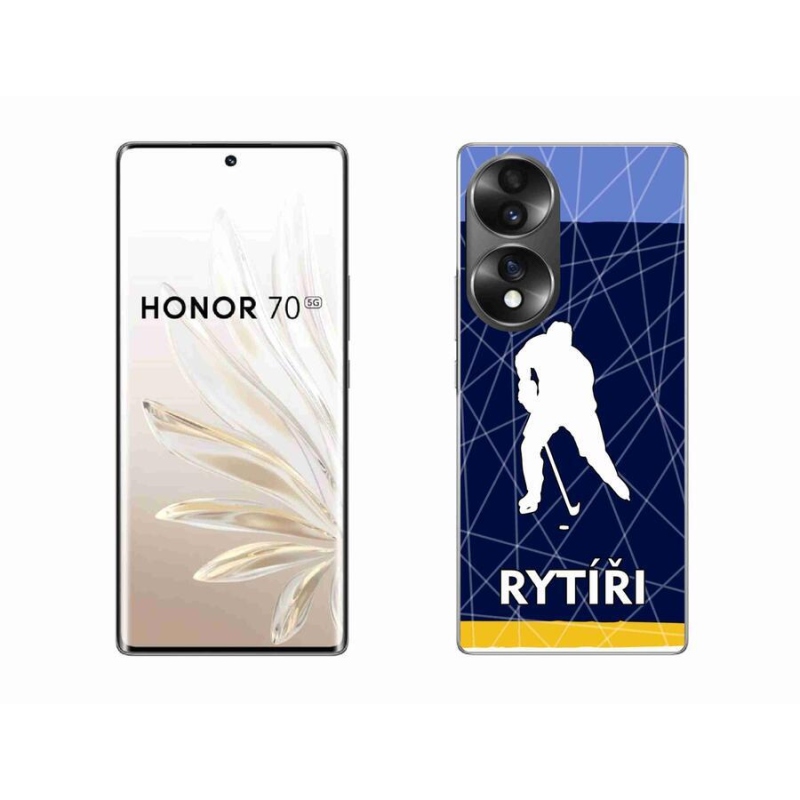 Zselés borítás mmCase for Honor 70 - Knights