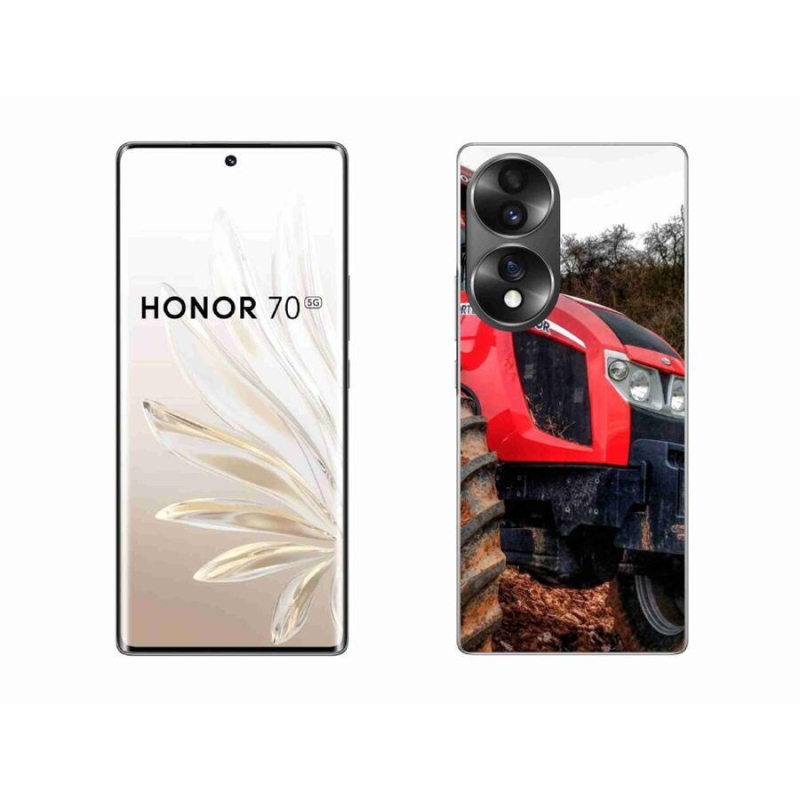 Zselés borítás mmCase a Honor 70 készülékhez - zetor