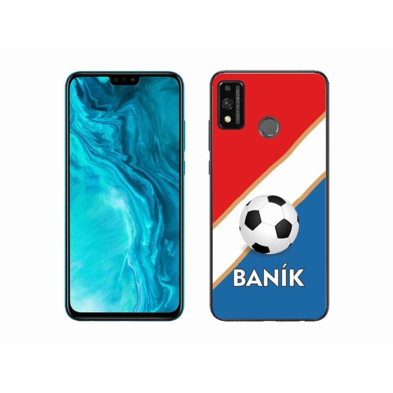 Zselés borítás mmCase a Honor 9X Lite készülékhez - Baník