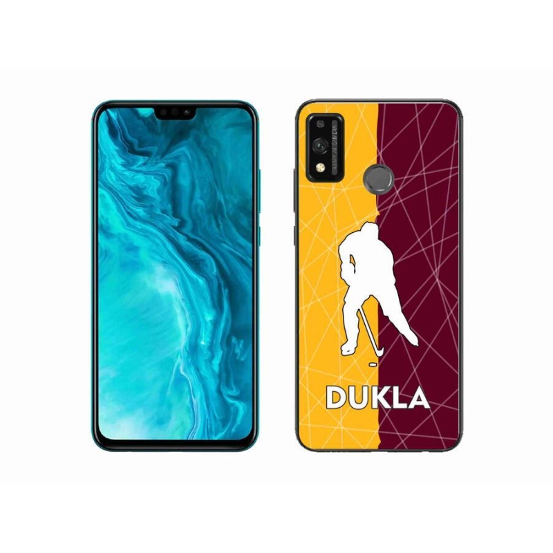 Gél borítás mmCase a Honor 9X Lite készülékhez - Dukla
