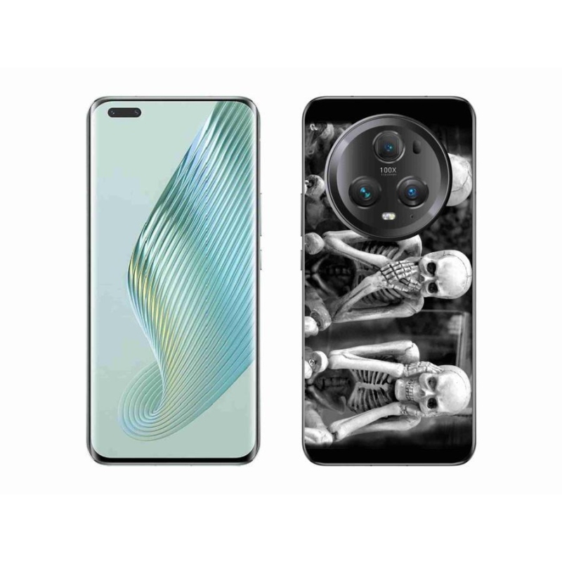 Gél borítás mmCase a Honor Magic 5 Pro 5G számára - csontvázak