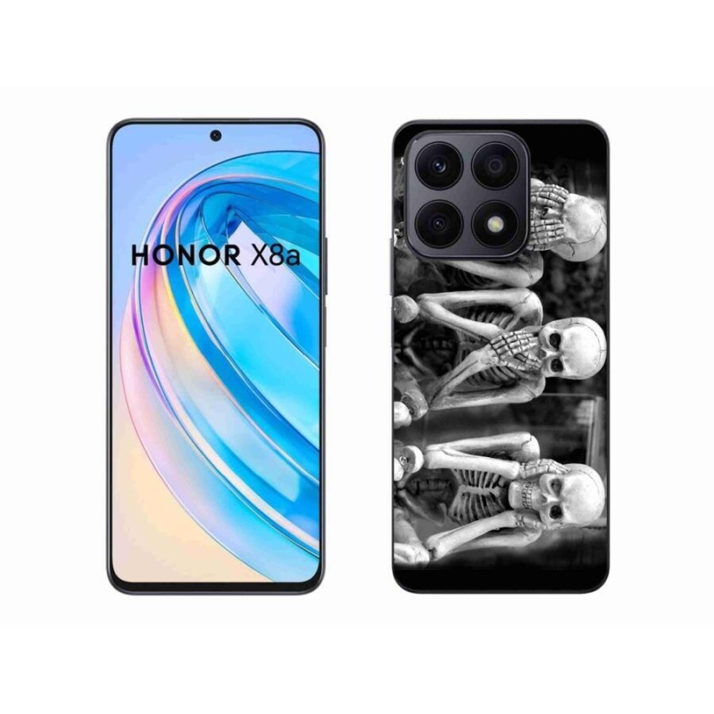 Zselés borítás mmCase a Honor X8a számára - csontvázak