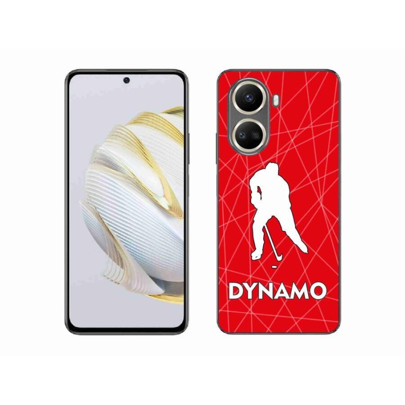 Gél borítás mmCase a Huawei Nova 10 SE-hez - Dynamo 2