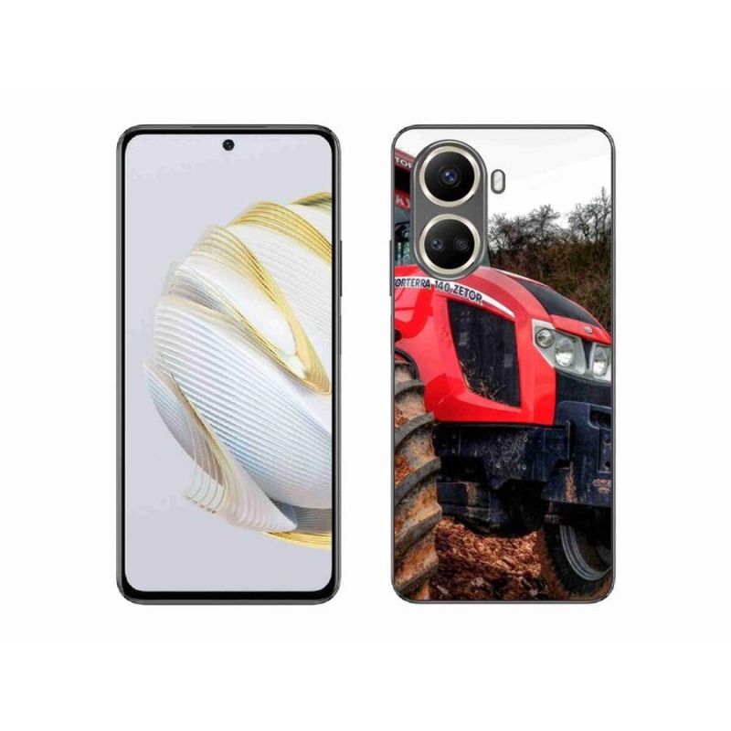 Gél borítás mmCase a Huawei Nova 10 SE-hez - zetor